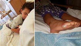 英國威爾斯一名媽媽日前帶4歲女兒買新鞋時，女童光腳試穿不少鞋子，沒想到回家後，女童竟出現發燒、抽搐等症狀。醫師檢查發現，女童罹患敗血症，所幸及時治療沒有大礙。（圖／翻攝自《Jodie Thomas》臉書）