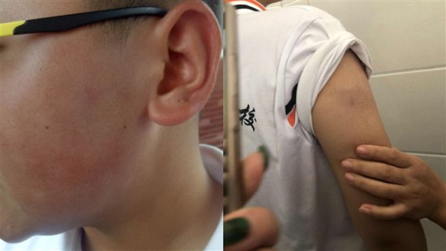 幫女友出氣！男師拿凳子毒打28學生