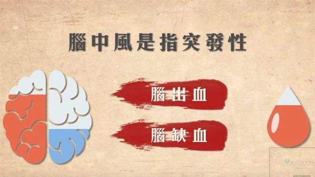 快看！中風的十大前兆　火速就醫