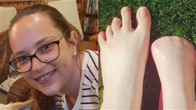 ▲庫爾瑟伊斯右腳腳趾全部截肢。（圖／翻攝自臉書、太陽報）
https://goo.gl/p8L8Pv