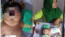 慎入！婦產下「獨眼無鼻女嬰」　僅存活7小時（圖／翻攝自Daily Mail）