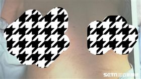 88歲婦人右乳房有1個硬塊未積極處理，腫瘤逐漸變大竟如熟透紅蘋果從皮膚表層爛出來。（照片經馬賽克處理／記者楊晴雯翻攝)