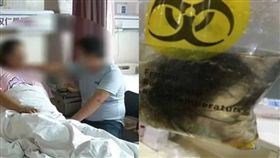 大陸22歲女卵巢畸胎瘤藏頭髮＋小骨頭／騰訊．大楚網