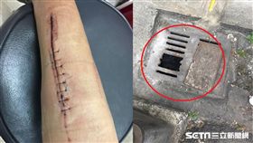 踩路邊水溝突斷裂　婦小腿墜溝遭割傷炸裂／陳先生提供