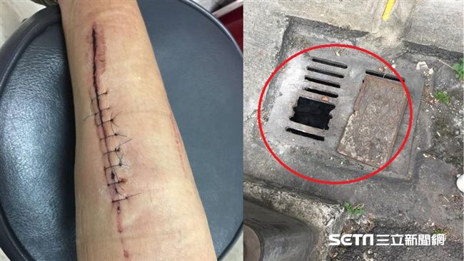 婦路邊踩水溝蓋突下墜　右小腿慘炸裂