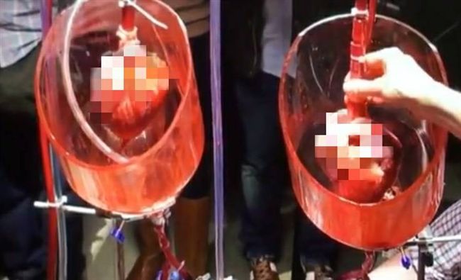 當台諜很好賺？踩紅線！腎臟被活摘下