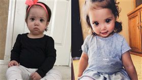 美國,明尼蘇達州,眼睛,青光眼,Axenfeld-Rieger syndrome（圖／翻攝自推特）