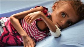 葉門內戰,飢餓,飢荒（圖／翻攝自Save the Children）