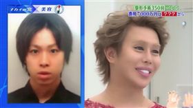 整形　Allen 翻攝Twitter