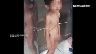 遭凌虐3歲男童　有學習遲緩行動障礙