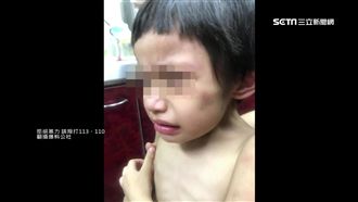 姊做「弟弟死掉」惡夢！意外揭虐童案