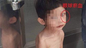 不忍！3歲童綁陽台遭虐　餓到抓穢物