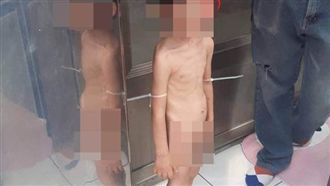 3歲童遭虐抓糞吃　王薇君：全力協助