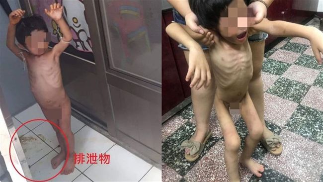 3歲童餓到吞穢物　網：生父恐是幫兇