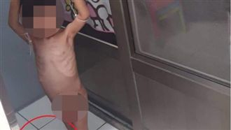 疑凌虐3歲兒　生父：亂大小便才管教