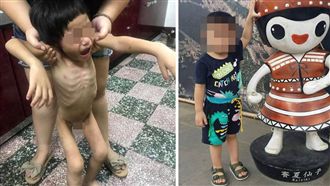 受虐男童罹患亞斯伯格症　遲未受治療
