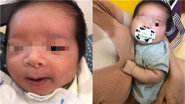 爸替兒辦健保卡　拿錯「鼻屎照」糗了