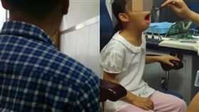 大陸,湖南,父女,腺樣體,親子鑑定（圖／翻攝自梨視頻）