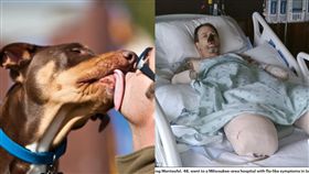 美國／愛犬舔一口 竟染細菌截四肢！ 削鼻男仍道：不是狗的錯（圖／翻攝自Daily Mail,PIXABAY）