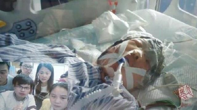 農婦下田長髮捲入收割機　頭皮遭掀起