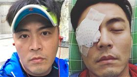 劉至翰/青光眼/開刀/老婆Vivian。(翻攝臉書)