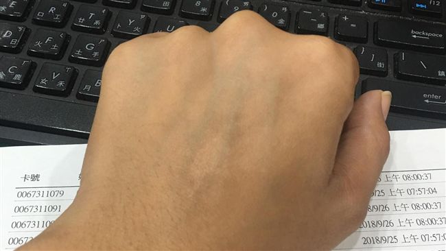 可怕！她驚爆哥貪玩遭媽「用火處罰」