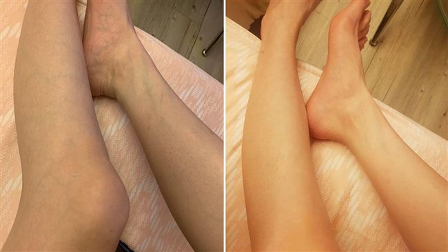 愛瘋照妖鏡？她傻爆眼「拍腿像中毒」