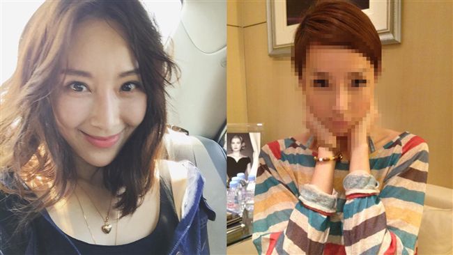 隋棠認臉縫50多針　迷人酒窩是假的