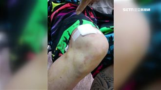 遭仇家開槍轟膝　醫見槍傷通報才揭案