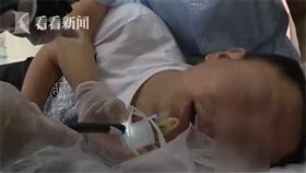 大陸遼寧一名男子日前與朋友喝酒時，沒注意瓶蓋掉在酒內，整杯啤酒一口氣喝下肚，結果瓶蓋卡在胃內。醫師擔心取出瓶蓋會割傷到男子的腸胃、食道，於是叫男子吞下「保險套」，再用鉗子把瓶蓋放進保險套中，順著食道將把保險套拿出來。不少網友看到後，紛紛直呼「保險套真的是萬能的！」（圖／翻攝自看看新聞）