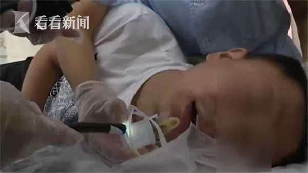 男喝酒誤吞瓶蓋　醫用「保險套」取出