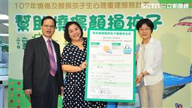 燒燙傷,中華郵政,陽光基金會,副總經理,吳元仁,顏損孩子,／中華郵政提供