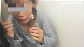 新北市，林口，虐童，功課不佳，受傷