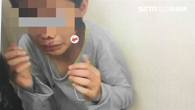 8歲童遭虐全身傷　挨餓僅能喝水充飢