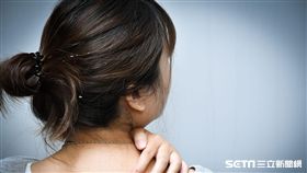 醫師黃毓惠提醒，國外研究顯示，近8成乾癬病灶會出現在頭皮。（示意圖／台灣乾癬協會提供）