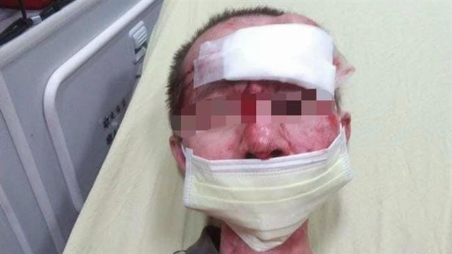 醉男打人抓頭撞地　嗆沒監視器要他死