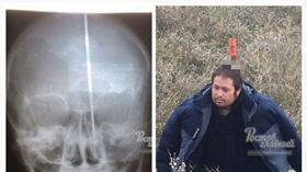  ▲長刀剛好卡在尤里的左右腦間。（圖／翻攝自Ростов Главный - новости Ростова-на-Дону VK）
https://goo.gl/orV1np