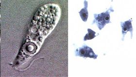 寄生蟲,度假.美國,戲水,入侵,食腦蟲,變形蟲,脊髓　圖／翻攝維基百科　https://goo.gl/jEgcUk