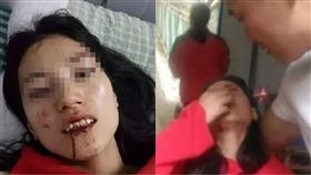 大陸,河南,長壽山,滑梯,賠償,受傷,中國,拍照,遊玩,流程,處理 圖／翻攝自微博　