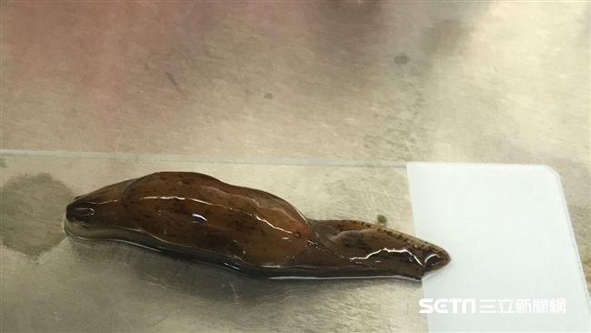 遭慫恿活吞蛞蝓…19歲男孩終身癱瘓