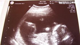 少子化,懷孕,凍卵,不孕,寶寶,分娩,孕婦（圖／記者李鴻典攝）