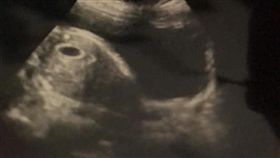 懷孕,流產,求子,空包彈,／翻攝自爆怨公社