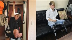 變形人生／燒傷毀容只剩左手，鋼鐵女孩「願我成為別人祝福」，莊雅菁