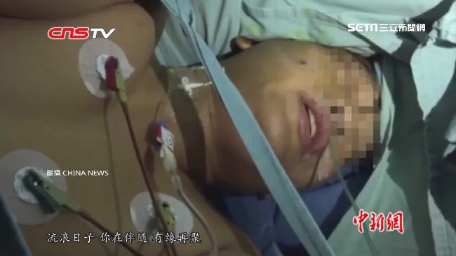 開腦開一半…醫生竟要病人開口唱歌