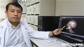 醫師呂明川說明黃姓婦人病因。（圖／彰化醫院提供）