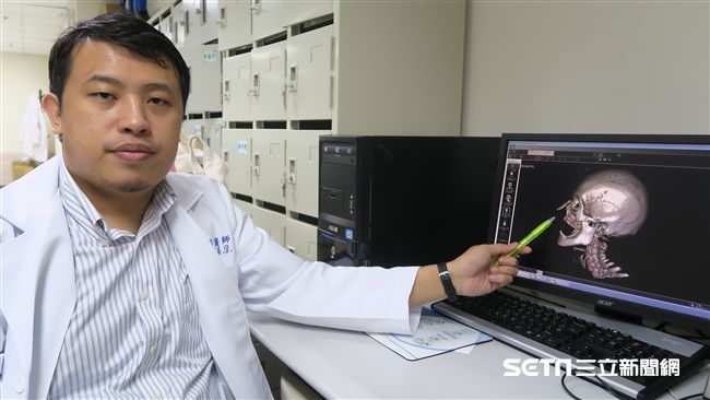 愛美隆鼻　50年後竟眉心噴膿臉青