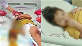 被眼鏡蛇咬傷卻瞞家人 6歲女毒發：想幫爸爸省醫藥費(圖/翻攝自騰訊視頻,微博)