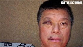 被打運將傷勢曝光