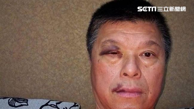 畫面曝光！他喝醉這樣毆打運將右眼！