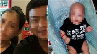 受虐男童四肢骨折腳踝變形　頭部重創